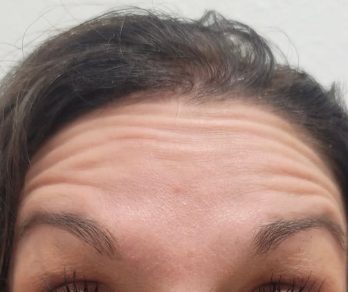 Close-up of forehead with horizontal wrinkles, dark hair, and well-groomed eyebrows