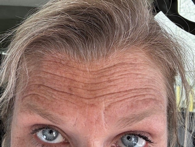 Close-up of a persons forehead and eyes showing facial wrinkles and skin texture