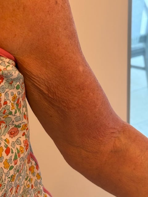 Persons arm with warm brown skin tone holding a colorful floral patterned fabric with red and yellow flowers